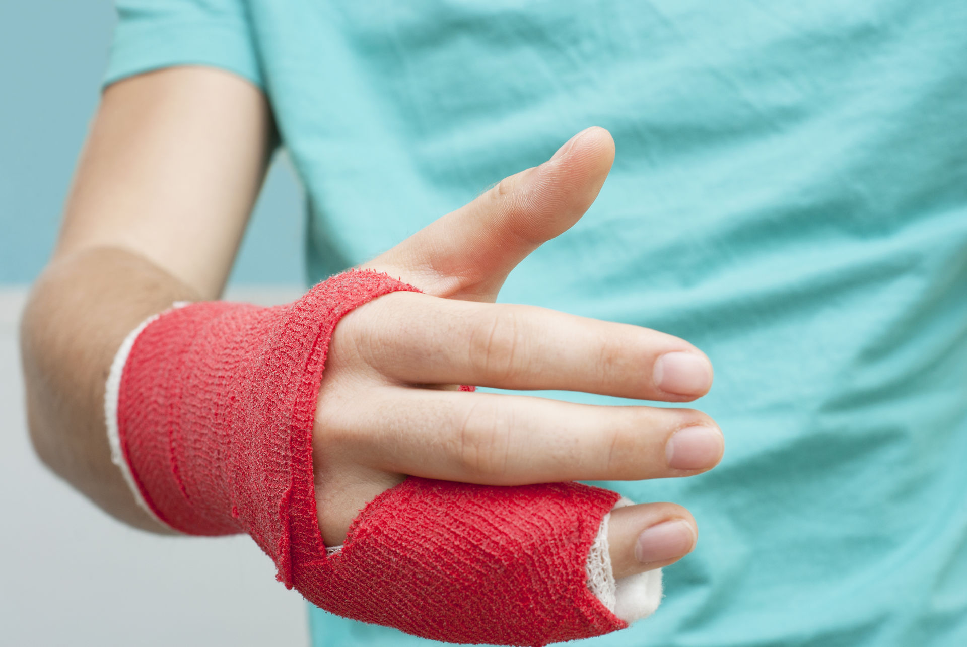 Une main immobilisée dans un plâtre